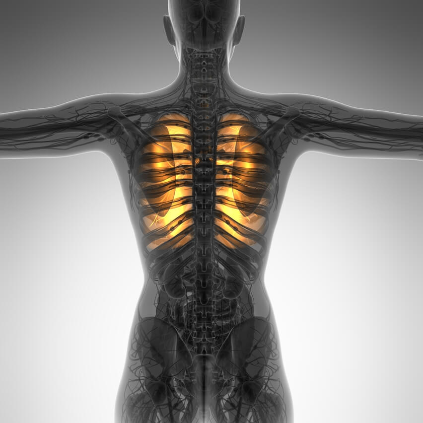 Lungs on x-ray with fumes to show how to clear lungs of spray paint